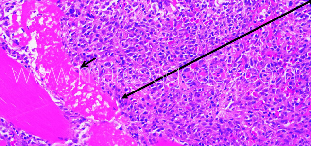 Exophiala muscle VII