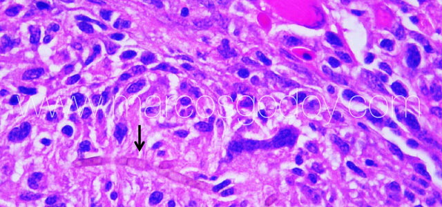 Exophiala muscle VIII