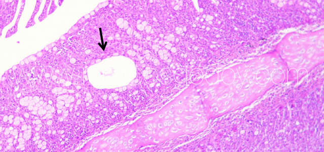 PGD HistologyX