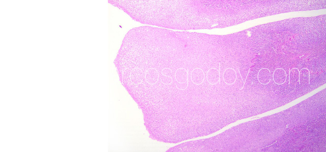 PGD Histology IV
