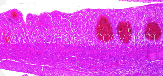 PGD Histology IX