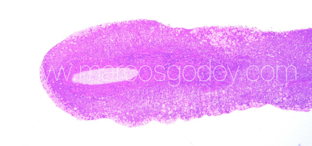 PGD Histology V