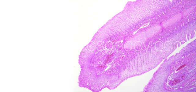 PGD Histology VI
