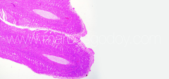 PGD Histology VIi