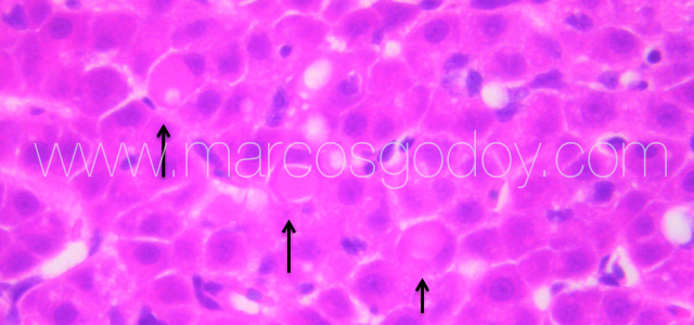 Eritrophagy II