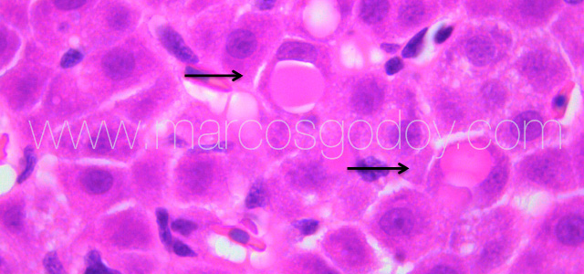 Eritrophagy III