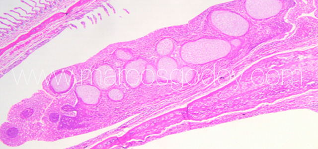 Condroplasia I