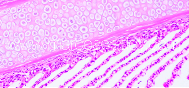 Condroplasia III