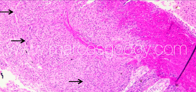 Epicarditis salmon 3