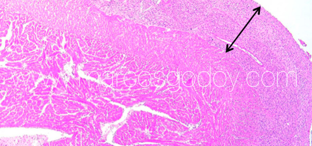 Epicarditis salmon 7