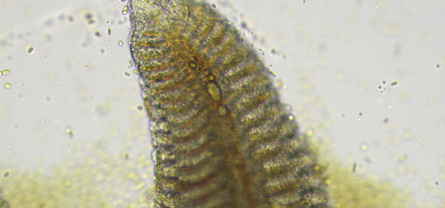Embolia branquial 2