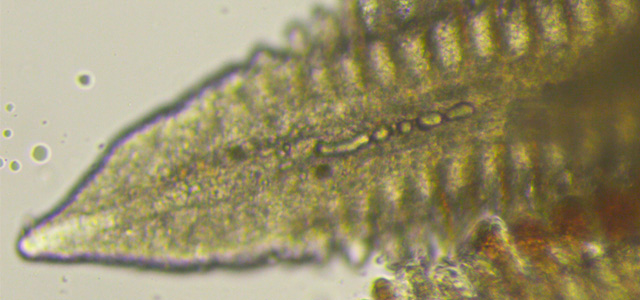 Embolia branquial 3