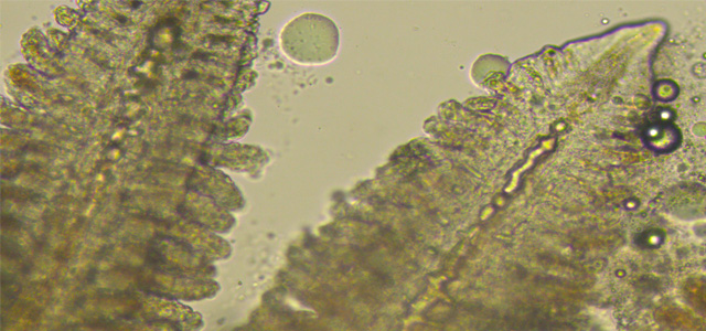 Embolia branquial 9