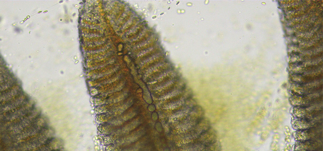 Emolia branquial 11