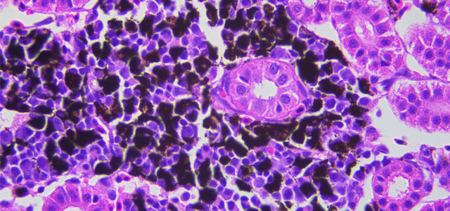 Salar BKD Melanomacrofagos IX