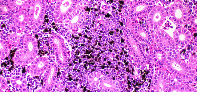 Salar BKD Melanomacrofagos VI