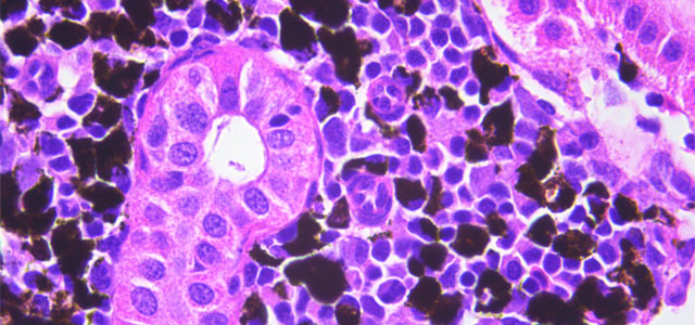 Salar BKD Melanomacrofagos VIII