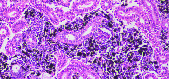 Salar BKD Melanomacrofagos X