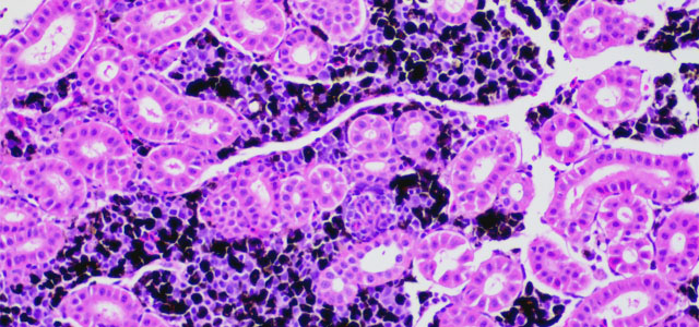 Salar BKD melanomacrofago I