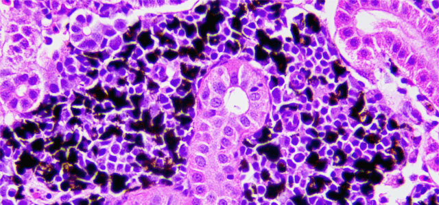 Salar BKD melanomacrofago IV