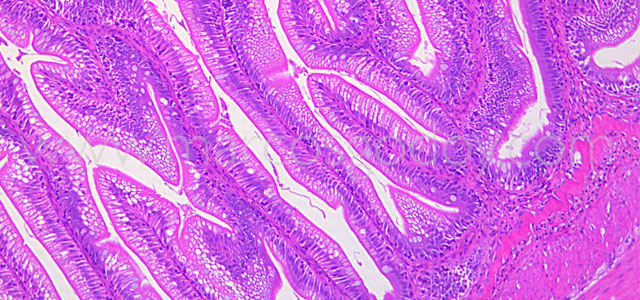 Enteritis Trucha 10x IV