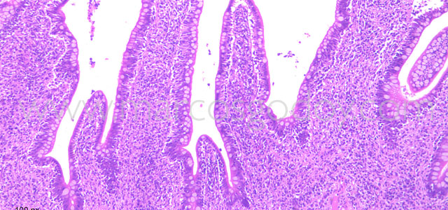 Enteritis Trucha 10x VIII