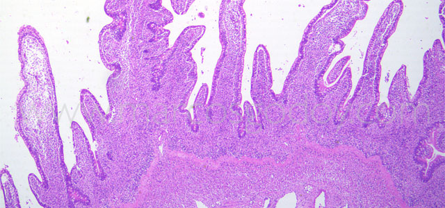 Enteritis Trucha 10x XI