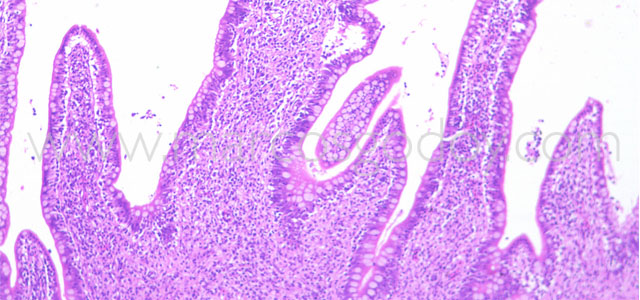 Enteritis Trucha 10x XII