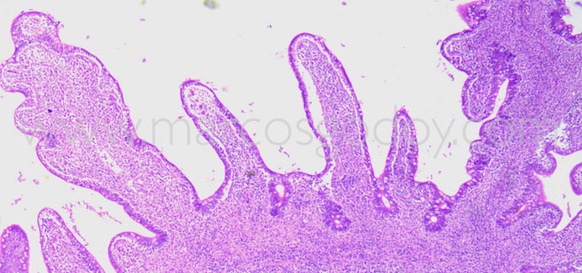 Enteritis Trucha 4x V