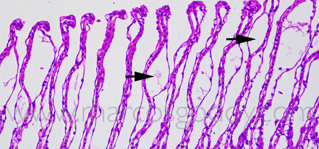 FAN gill pathology 20X X