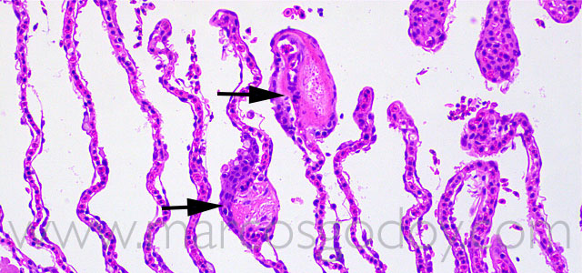 FAN gill pathology 20X XI