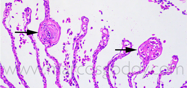 FAN gill pathology 20X XII