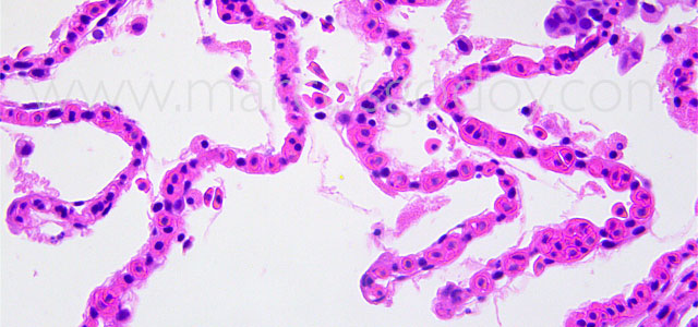 FAN gill pathology 40X XIX