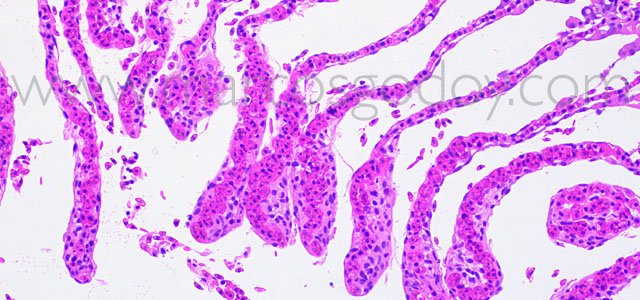 FAN gill pathology 40X XVII