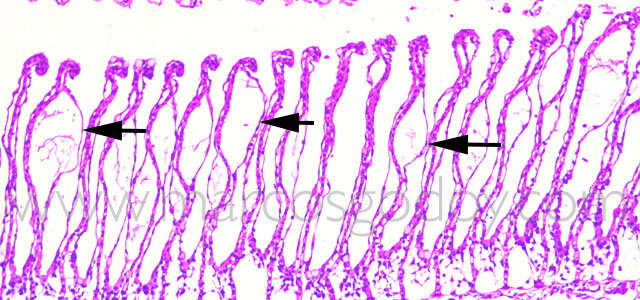 FAN gill pathology 40X XV copia