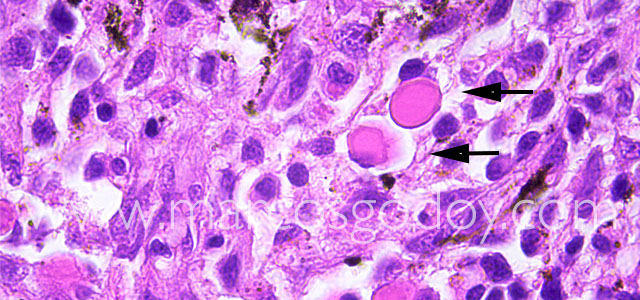 Mott cell 100X I