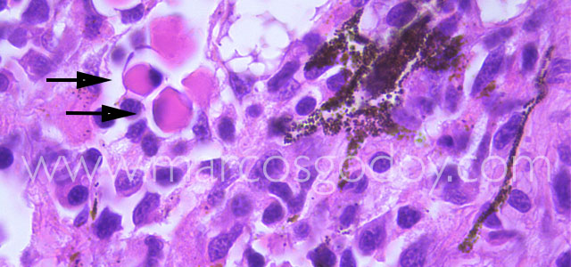 Mott cell 100X III