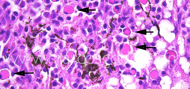 Mott cell 63X V
