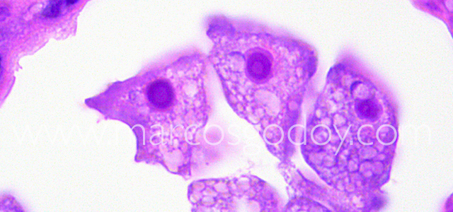 Ameba 100X