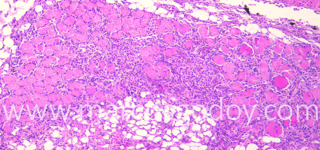 Miositis Flavobacterium Trucha 10X II