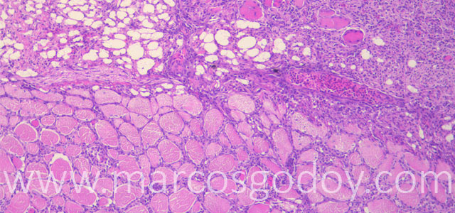 Miositis Flavobacterium Trucha 10X III