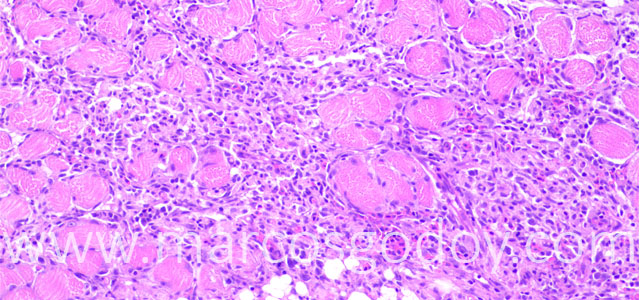 Miositis Flavobacterium Trucha 10X IV