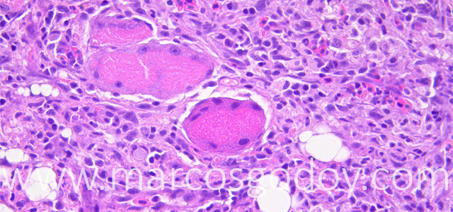 Miositis Flavobacterium Trucha 40X VII