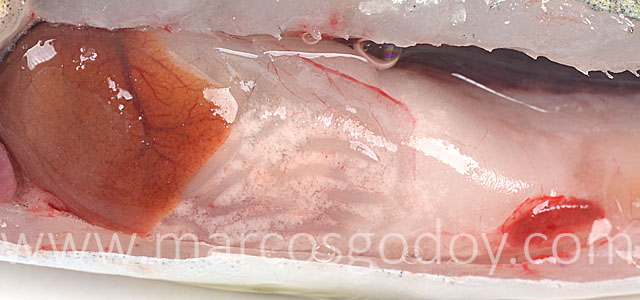 IPN visceral fat gross pathology II