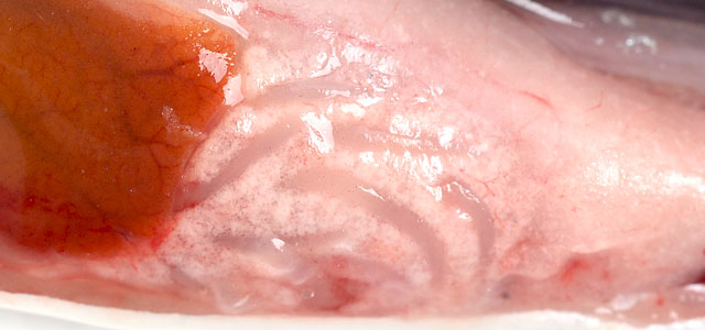 IPN visceral fat gross pathology IV