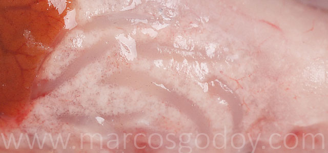 IPN visceral fat gross pathology V
