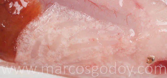 IPN visceral fat gross pathology XII