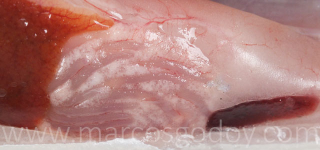 IPN visceral fat gross pathology XIX
