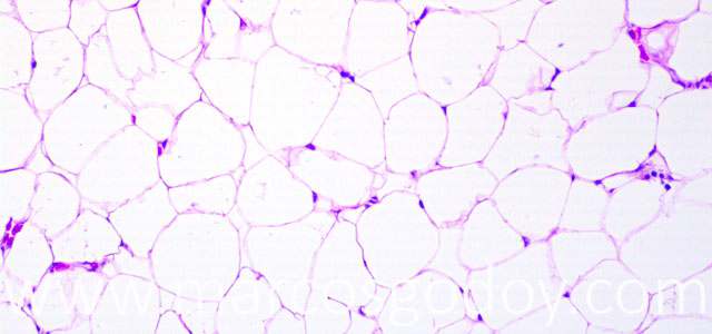 Esteatitis 20X III