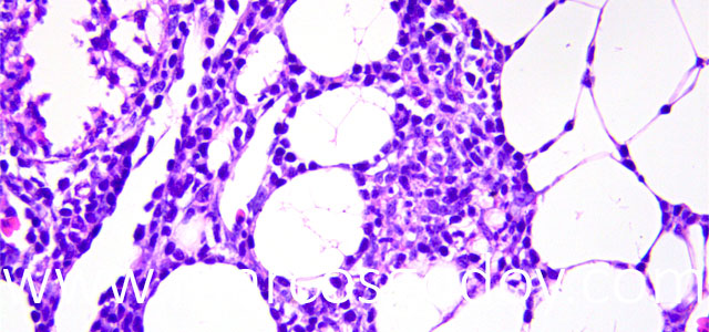 Esteatitis 40X VIII